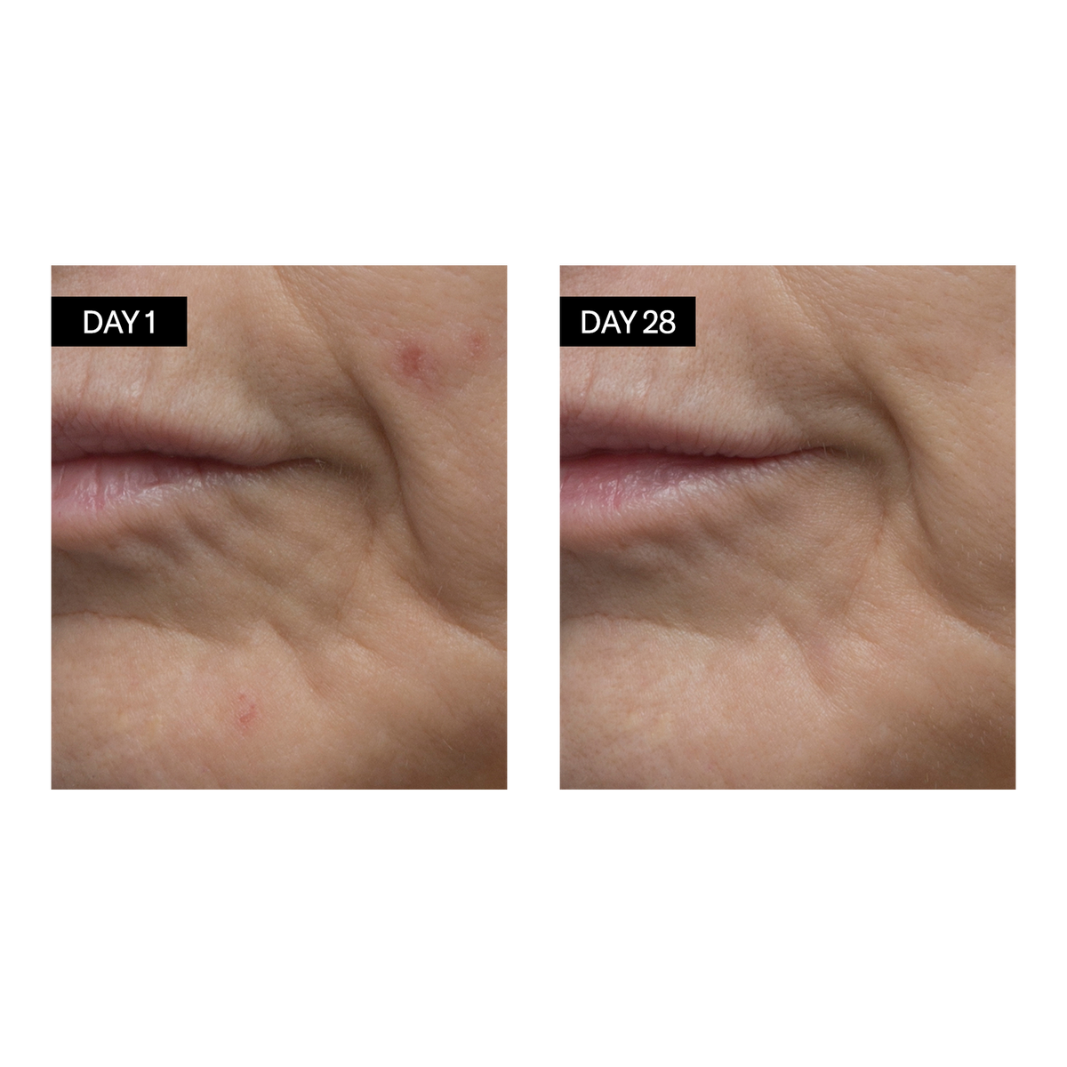 Renewing Serum • Retinol + Hyaluronic Acid Odacité