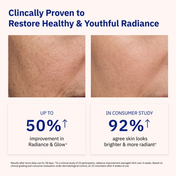 Before and after skin comparison using Odacité Cellular Infusion Cream • NAD+ Biomimetic Peptides, showing results after 28 days.