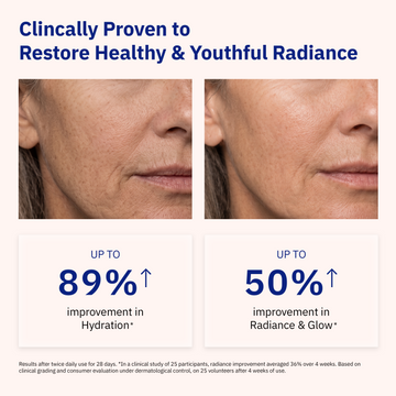 Woman’s face before and after Odacité Cellular Infusion Cream with NAD+ Biomimetic Peptides; skin appears smoother and brighter.