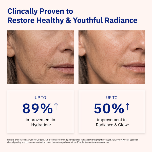 Woman’s face before and after Odacité Cellular Infusion Cream with NAD+ Biomimetic Peptides; skin appears smoother and brighter.