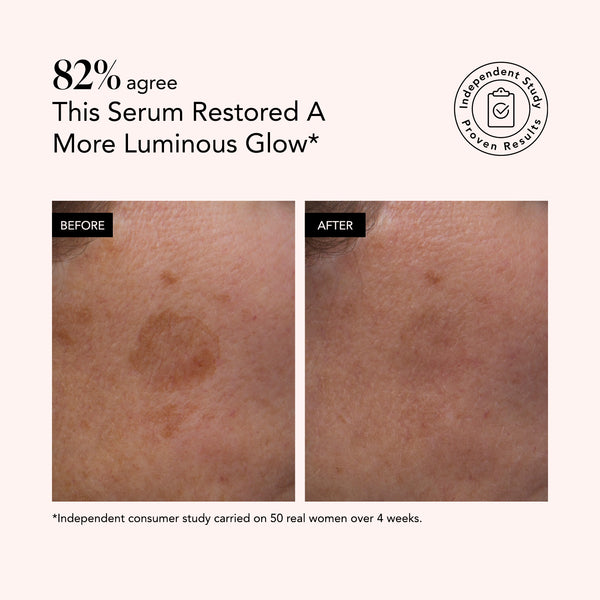 Side-by-side comparison shows reduced dark spots and more even skin tone after using Odacité Brightening Serum with Vitamin C & E + Hyaluronic Acid.