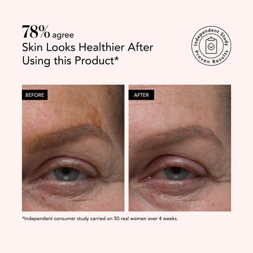 Before and after comparison of eye skin with a product's effectiveness highlighted.