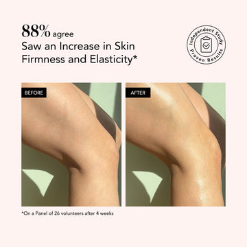 88% saw firmer, more elastic legs in 4 weeks using Odacité Hydra-Firm Full Body Routine with Vitamin C.