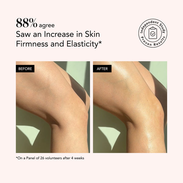88% saw firmer, more elastic legs in 4 weeks using Odacité Hydra-Firm Full Body Routine with Vitamin C.