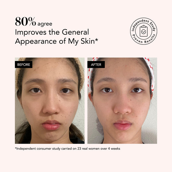 Odacité Clarifying Serum with Advanced Encapsulation Technology shown, highlighting an 80% user improvement statistic.