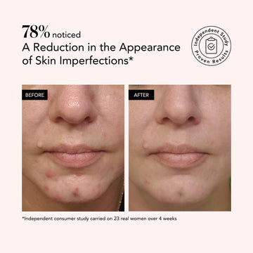 Clarifying Serum • Salicylic + Hyaluronic Acid