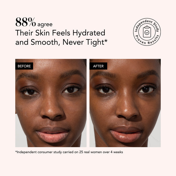 Side-by-side close-up of skin before and after using Odacité Jojoba Pearls + White & Rooibos Tea Daily Hydra-Exfoliant.