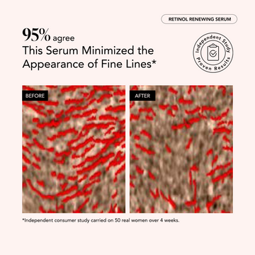 Before and after skin texture comparison showing a reduction in red-highlighted fine lines after using the Odacité Cellular Renewal Duo.