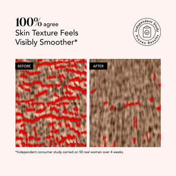 Side-by-side comparison shows skin with less redness and smoother texture after using Odacité Renewing Serum • Retinol + Hyaluronic Acid.