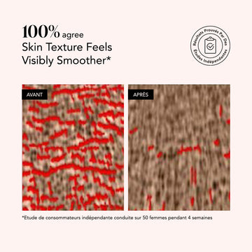 Before and after comparison of skin texture with visible smoother effect, conducted on 50 women for 4 weeks.