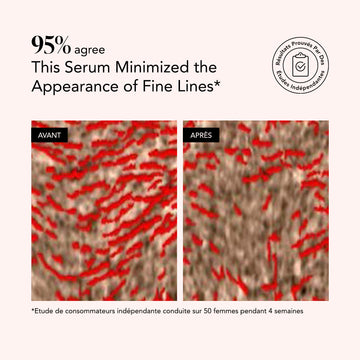Before and after comparison of skin texture with red lines, indicating serum effect, on a beige background.