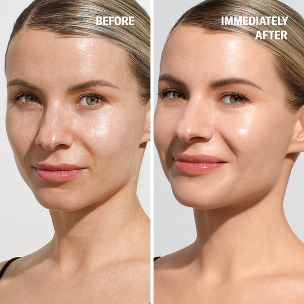 Woman’s face shown before and after Odacité Anti-aging Dream Duo SPF 50 + Retinol; skin appears smoother in the after image.